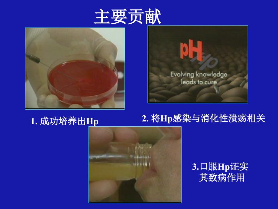 幽门螺杆菌Hpylori_第4页