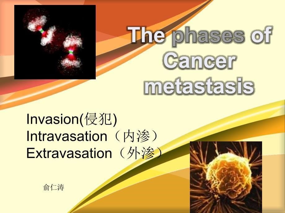 肿瘤转移 英文版_第5页