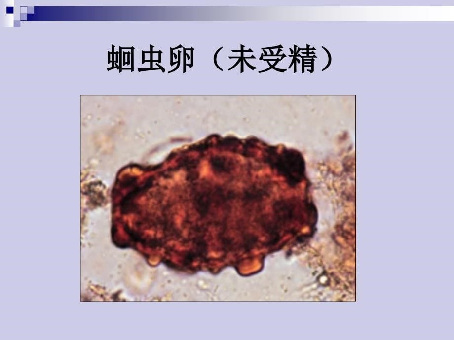 几种常见寄生虫课件_第5页