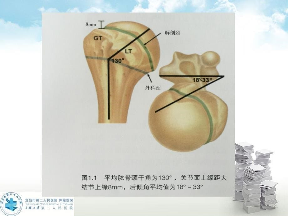 肱骨近端骨折的解剖和分型_第5页