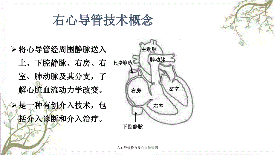 右心导管检查及心血管造影课件_第2页