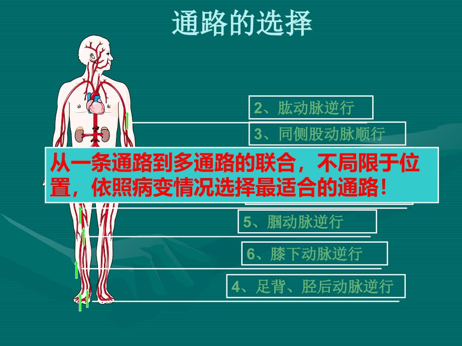 最新下肢动脉穿刺PPT文档_第1页