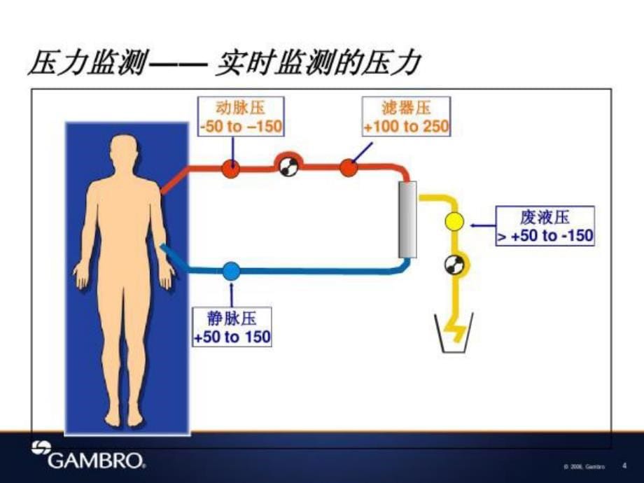 血液滤过常见的报警原因和非计划下机的处理方法_第5页