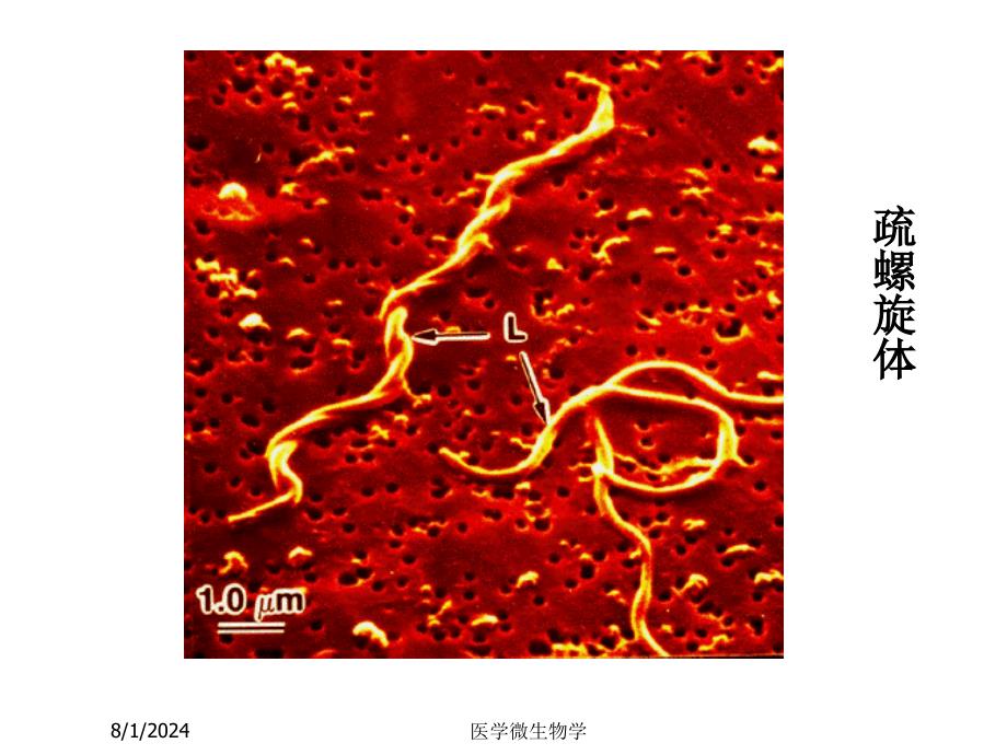 医学微生物学课件-第17章螺旋体_第3页