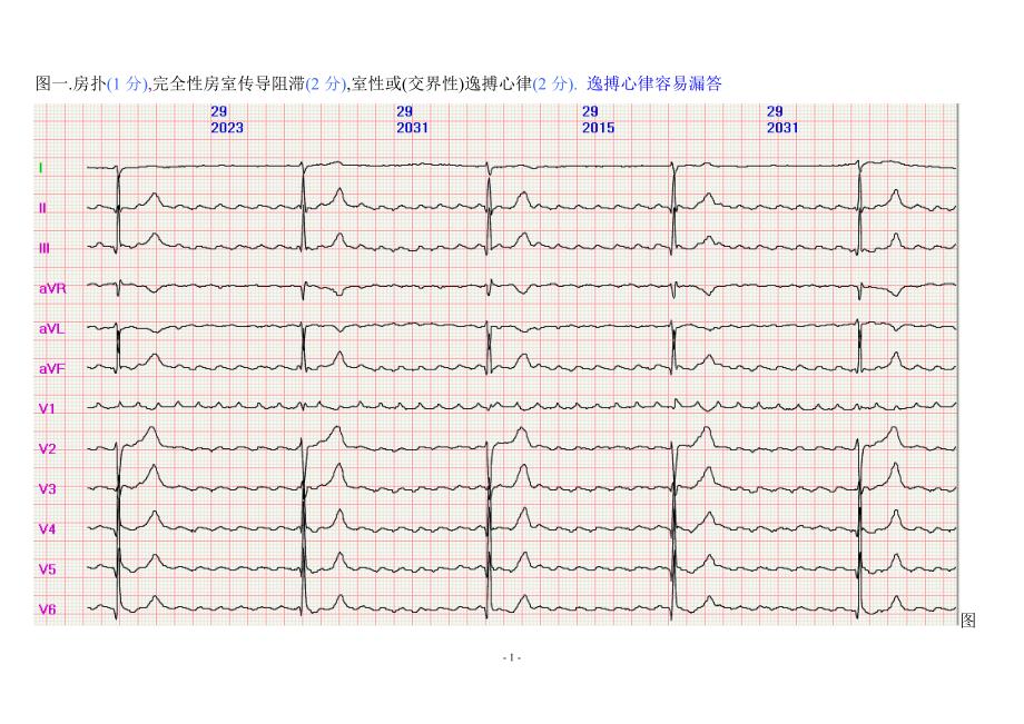 120心电图.doc_第1页