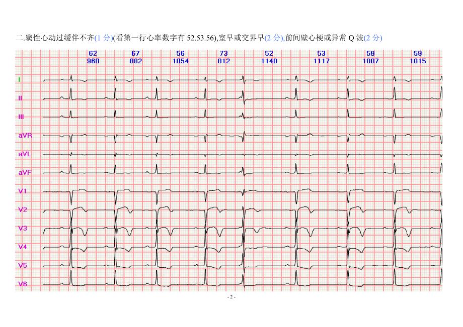 120心电图.doc_第2页