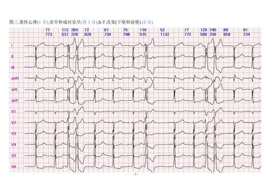 120心电图.doc_第3页