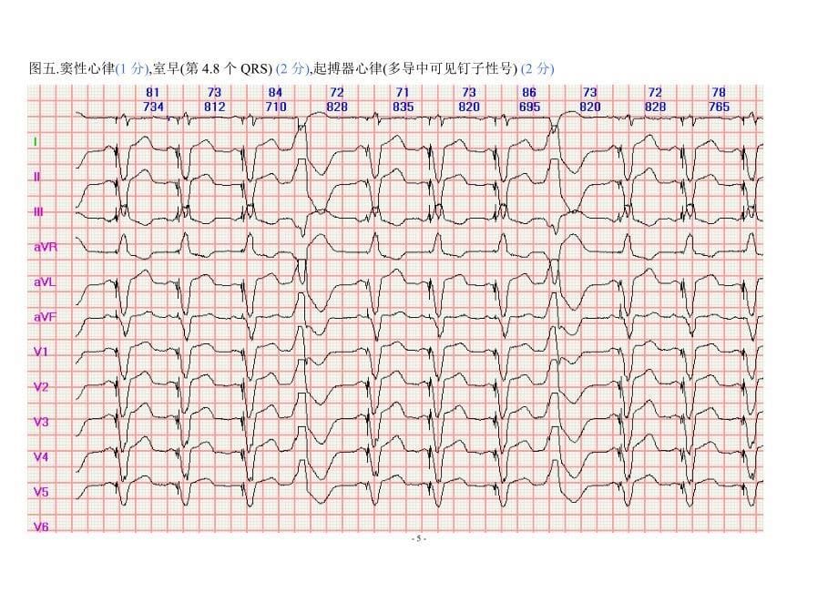 120心电图.doc_第5页