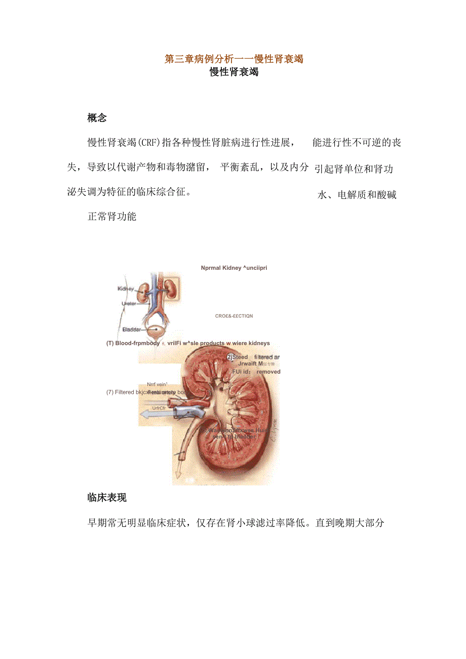 第三章病例分析——慢性肾衰竭_第1页