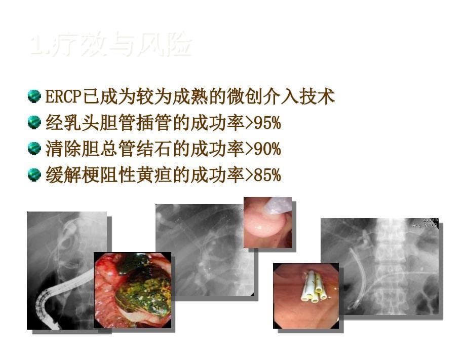 ercp诊治指南版解读_第5页