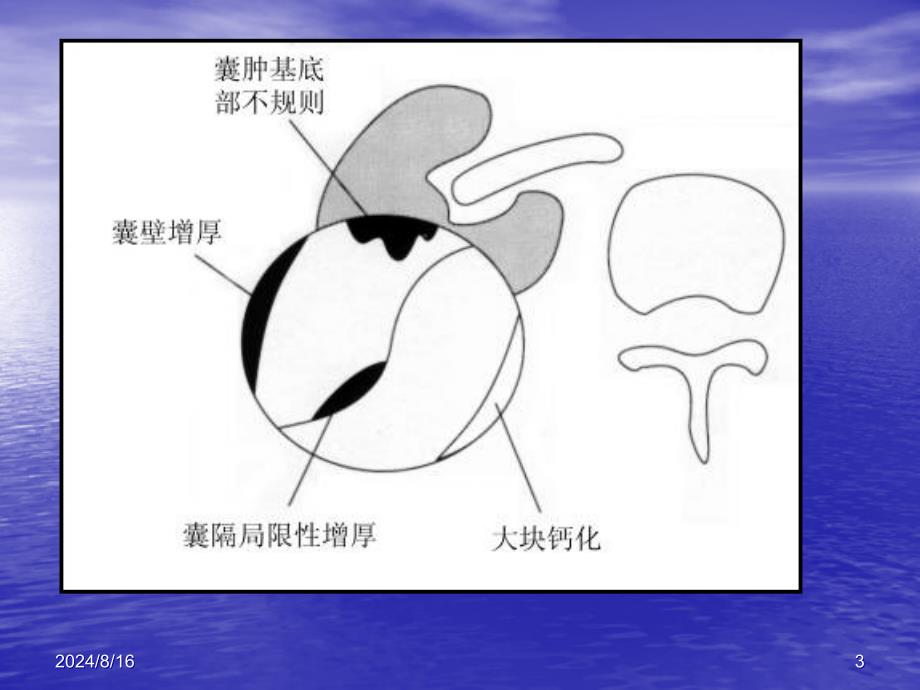 泌尿系统肿瘤医学PPT课件讲课讲稿_第3页