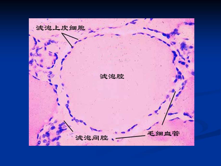 《甲状腺功能亢进》PPT课件_第3页