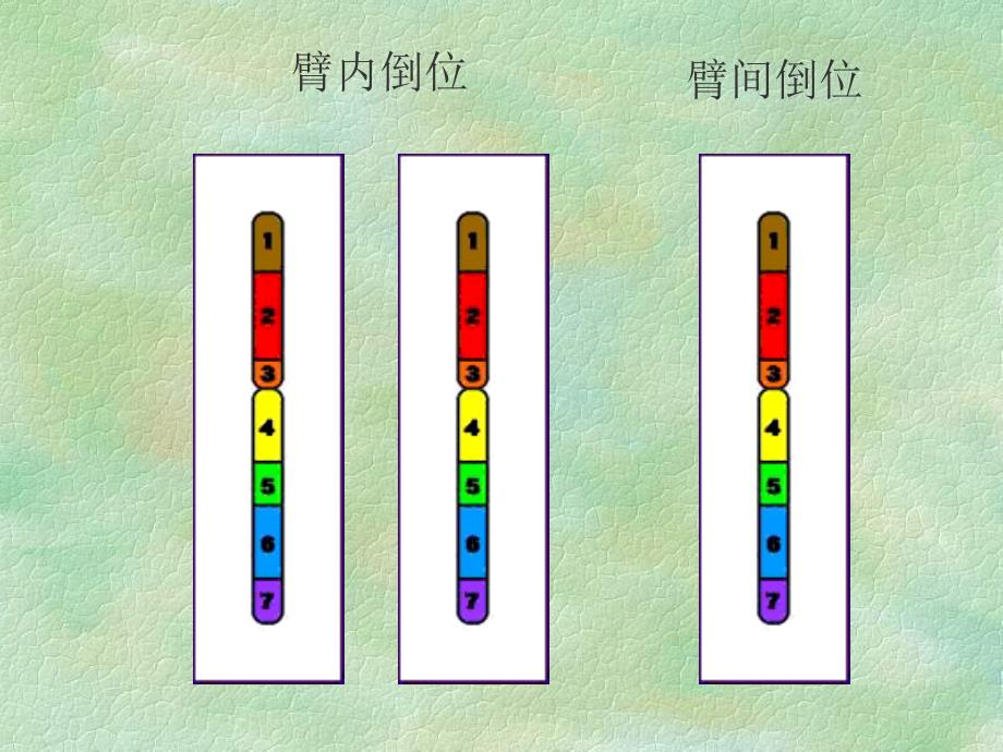 第2章染色体病4_第2页