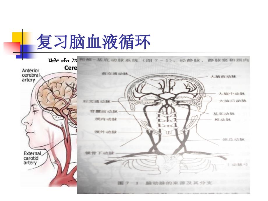 脑血管疾病病人护理PPT课件_第4页