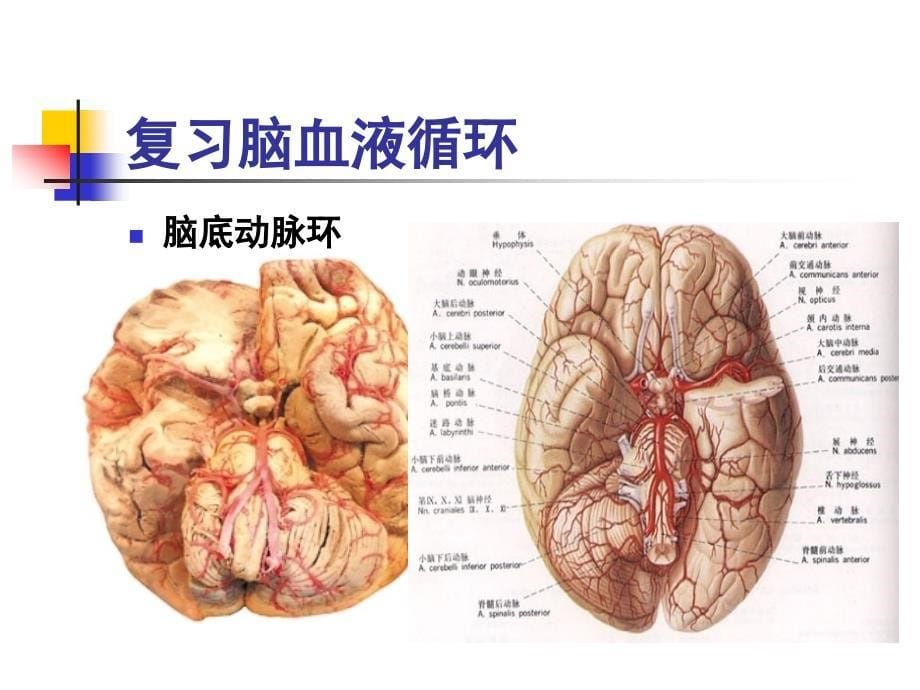 脑血管疾病病人护理PPT课件_第5页