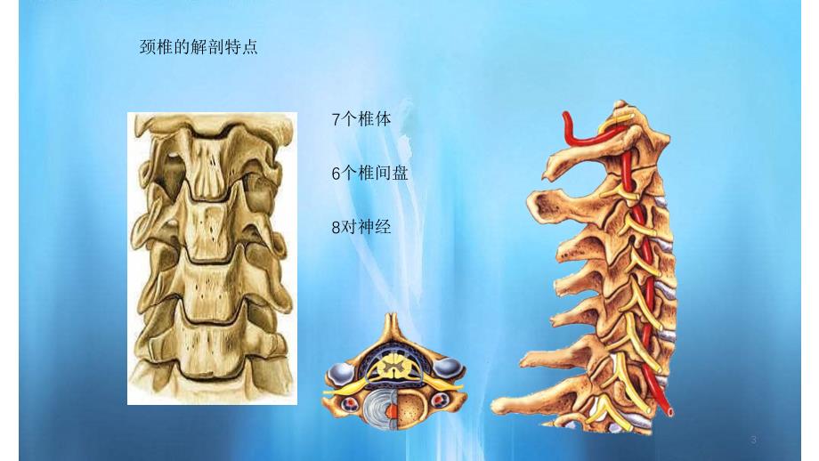 颈椎病的CT诊断（简单易懂）_第3页