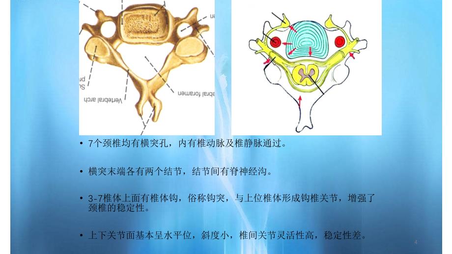 颈椎病的CT诊断（简单易懂）_第4页