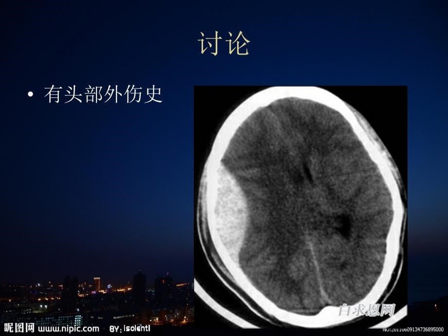 影像诊断学课件第二章中枢神经系6_第5页