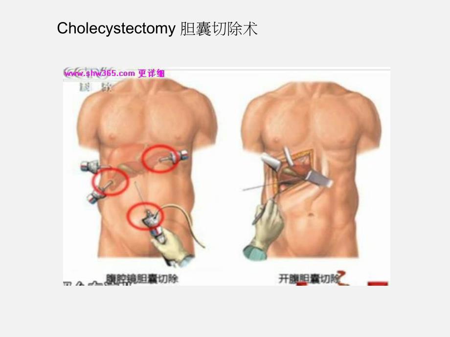 心肺功能不全的物理治疗诊断与治疗：general surgery_第4页