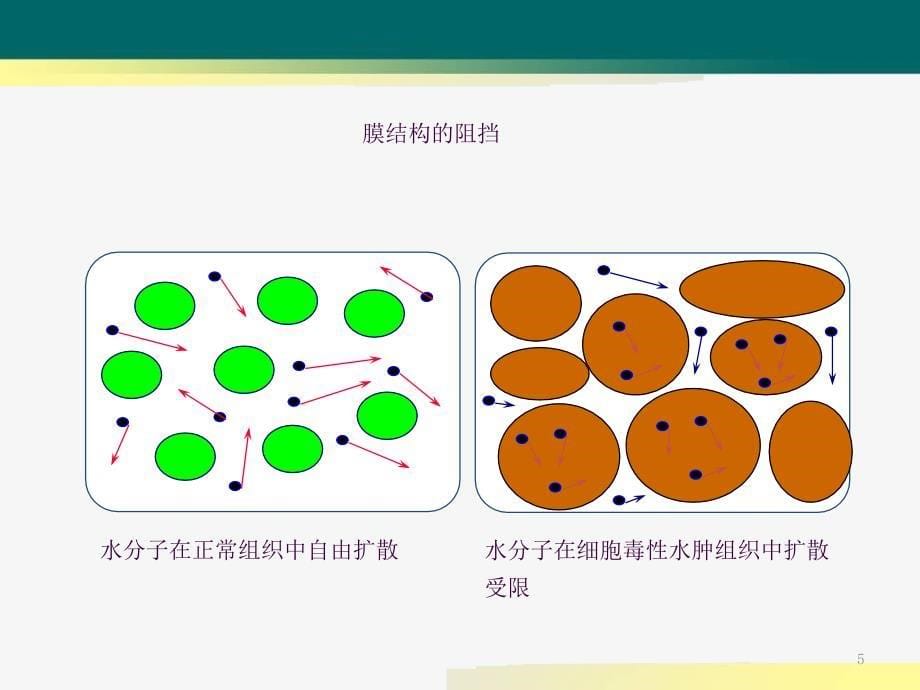 DWI在肝脏占位性疾病中的应用ppt课件_第5页