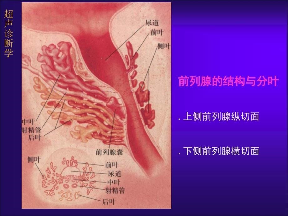 前列腺的超声诊断学_第5页