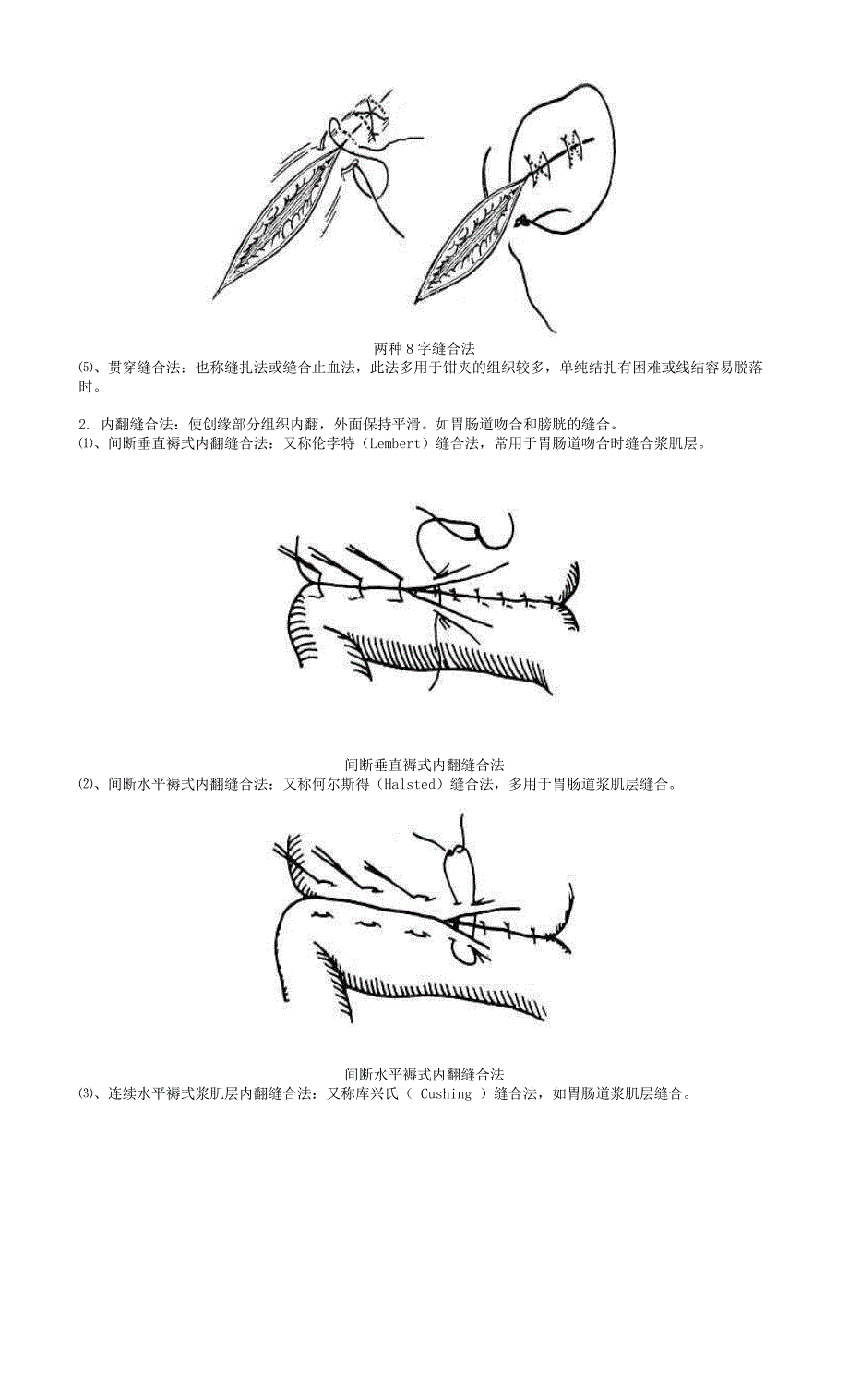 《手术缝合方法分类图解》_第3页