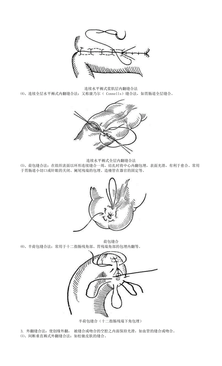 《手术缝合方法分类图解》_第4页