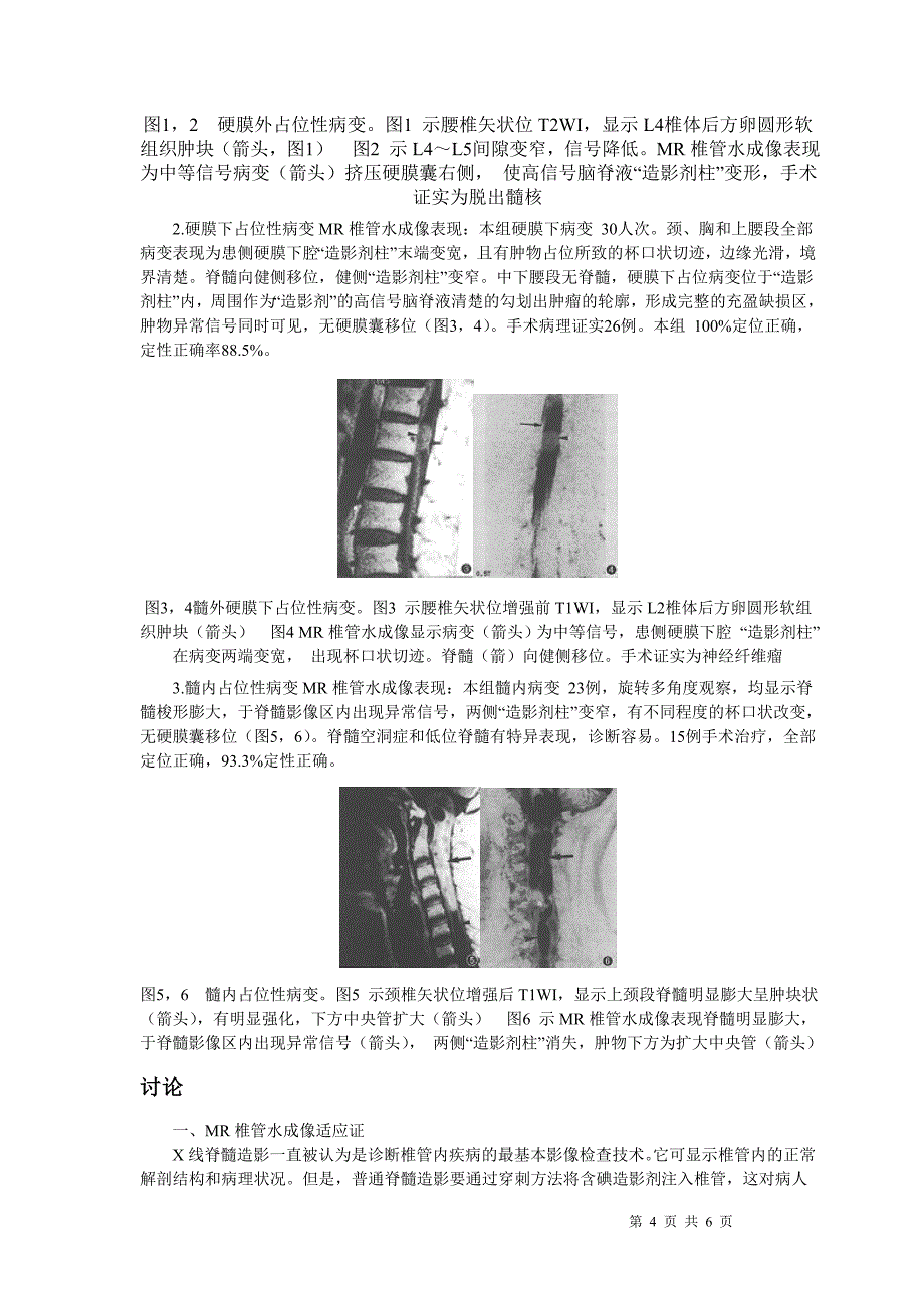 磁共振椎管水成像126例分析.doc_第4页