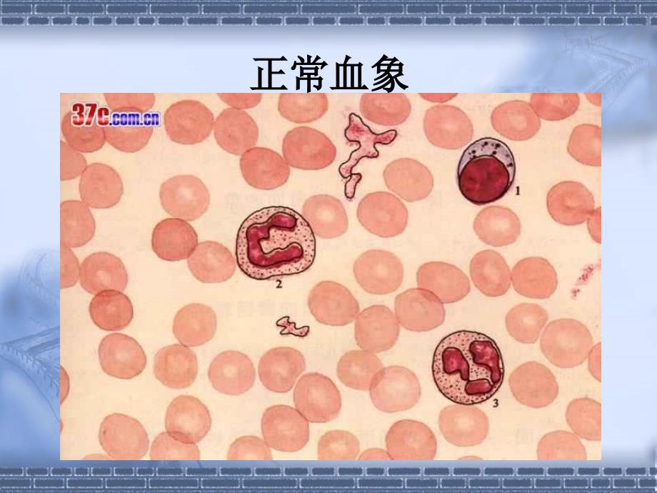 地中海贫血筛查方案与遗传咨询文档资料_第3页