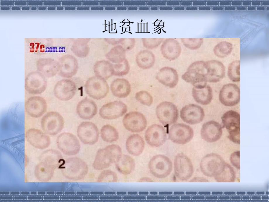 地中海贫血筛查方案与遗传咨询文档资料_第4页