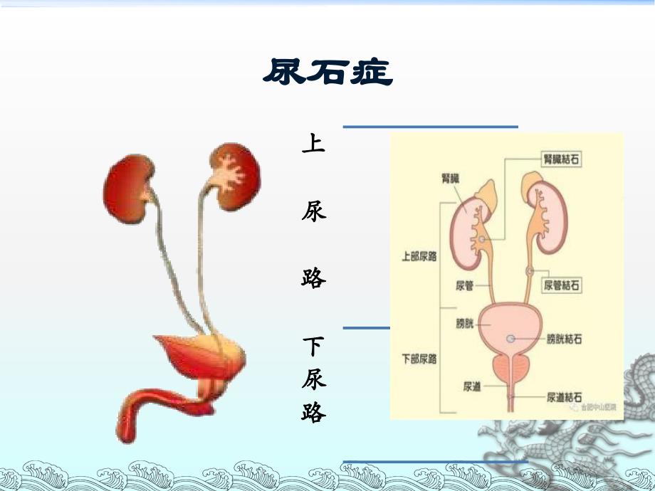 泌尿系结石的诊断及治疗培训资料_第2页