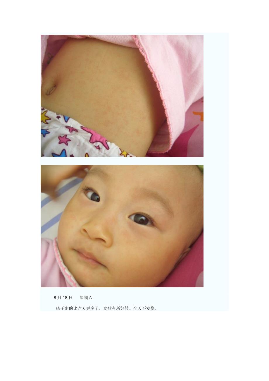 疱疹型咽峡炎、幼儿急疹 转帖 很不错 (宝宝发烧、腹泻的症状与治疗经过.doc_第4页