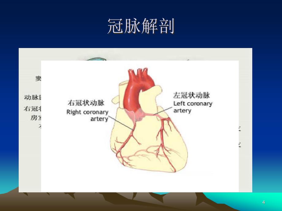 优质医学冠脉造影_第4页