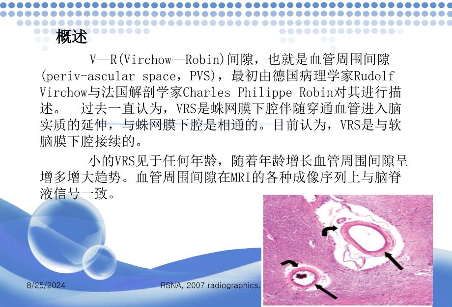 vr间隙mr成像表现ppt课件_第2页