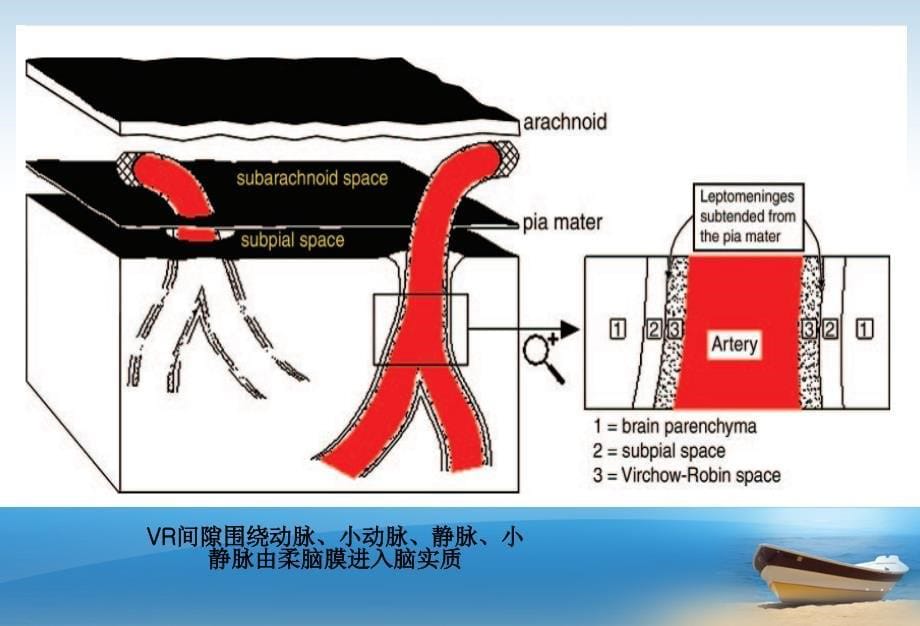 vr间隙mr成像表现ppt课件_第5页