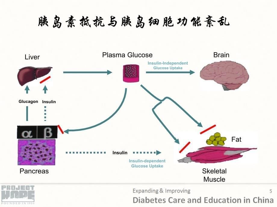 糖尿病的治疗pt课件_第5页