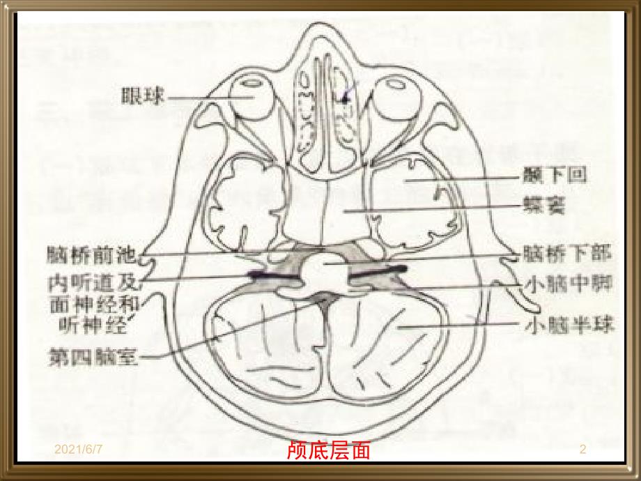 中枢神经系统断层影像PPT课件_第2页