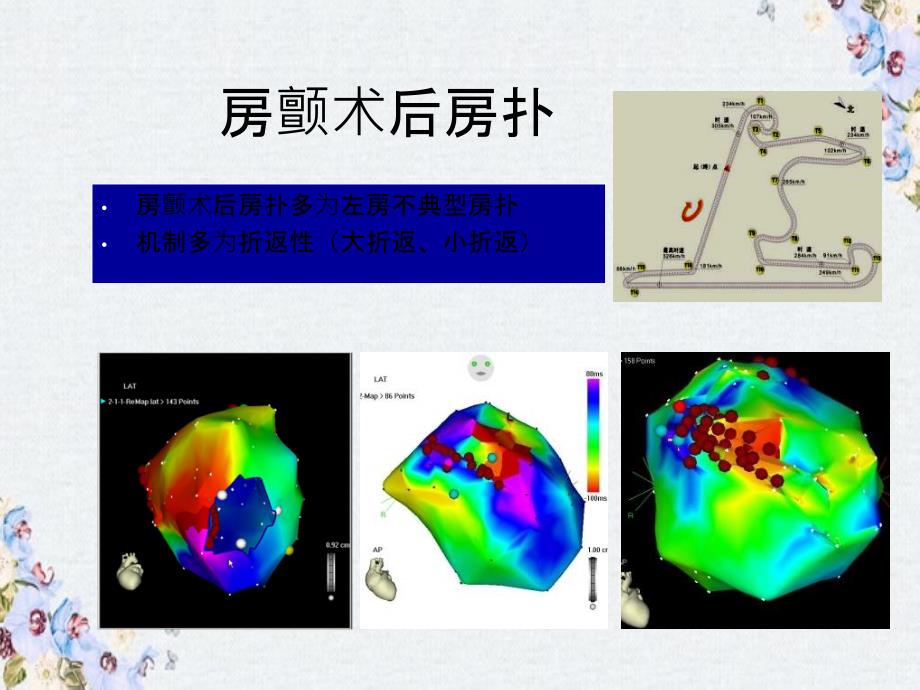 激动标测和拖带在房颤术后房扑治疗中的应用课件_第1页