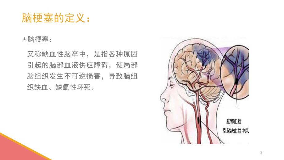 医学PPT课件脑梗塞护理查房幻灯片_第2页