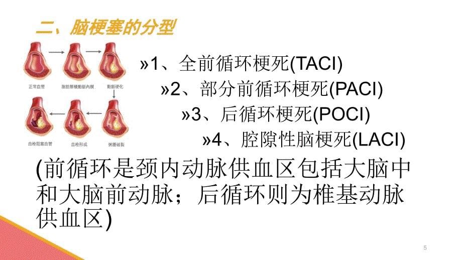 医学PPT课件脑梗塞护理查房幻灯片_第5页