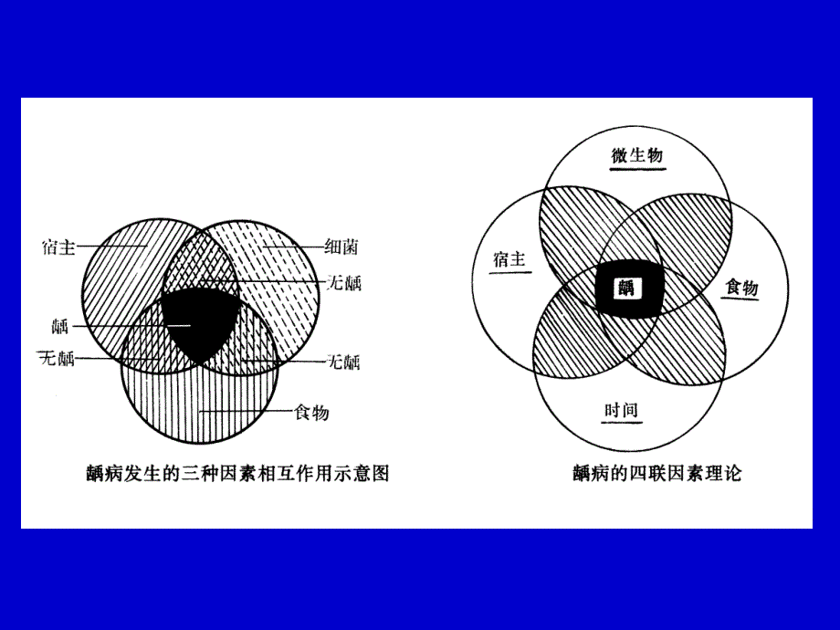 三章口腔科病人的护理_第4页