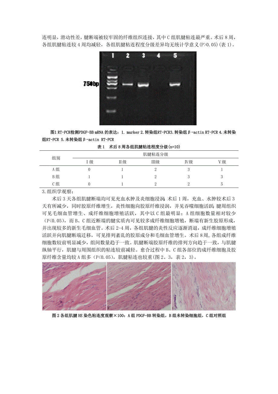 血小板源性生长因子BB表达对促进大鼠肌腱愈合和防止肌腱粘连的作用.doc_第3页