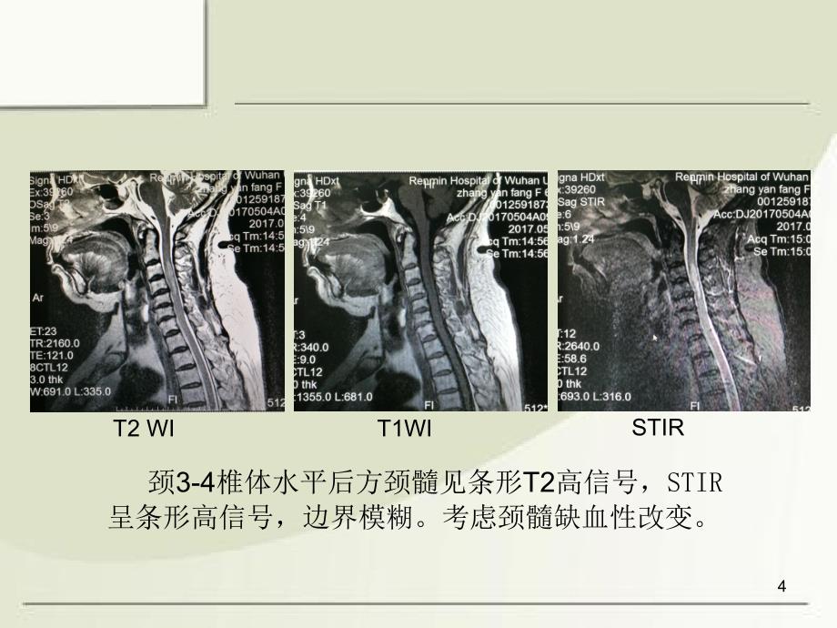 MRI诊断入门病例ppt课件_第4页