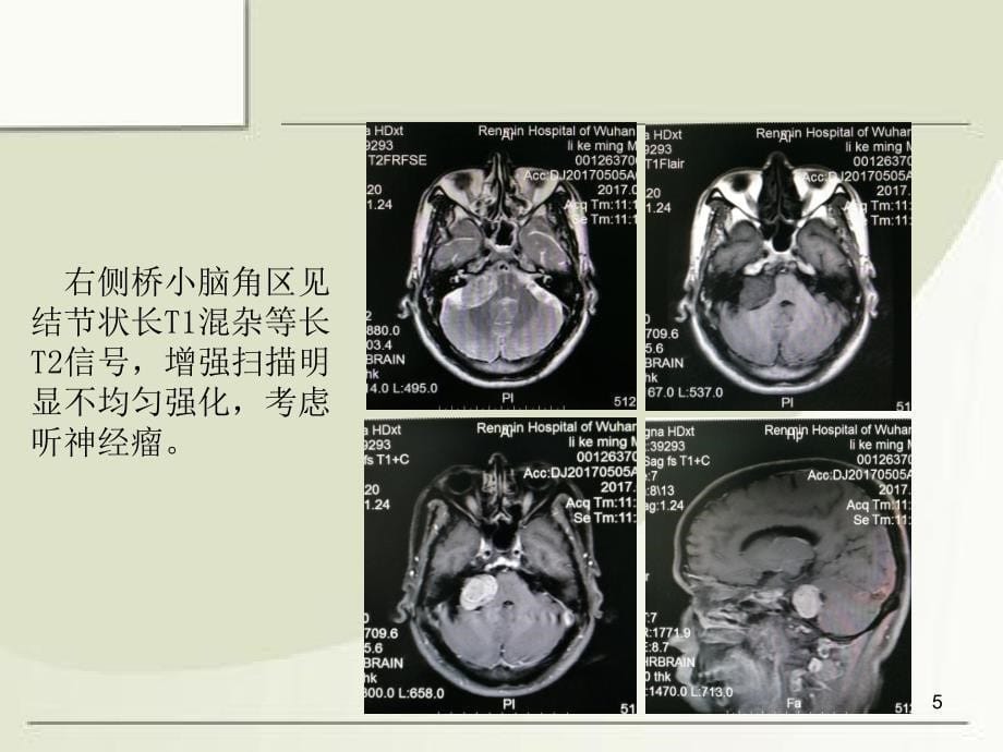 MRI诊断入门病例ppt课件_第5页