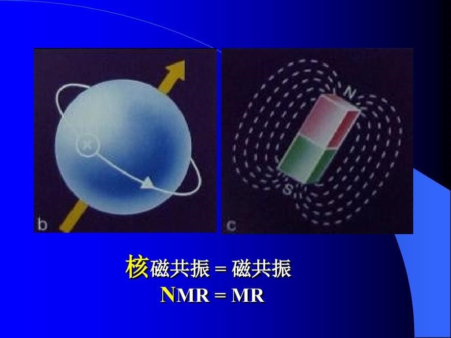 磁共振成像MagneticResonanceImagingMRI核磁共振成像技术发展_第5页