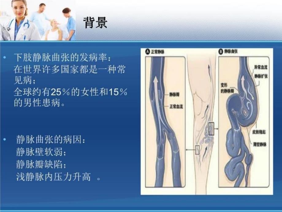 腔内激光闭合术课件_第3页