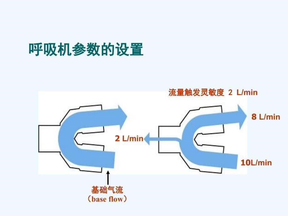 呼吸机参数的设置_第5页