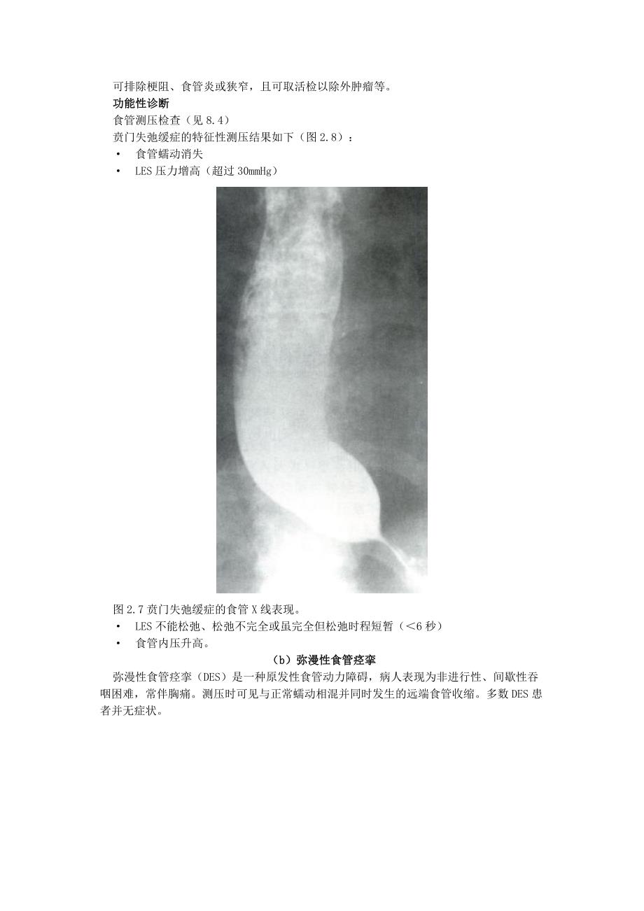 食管动力障碍.doc_第2页