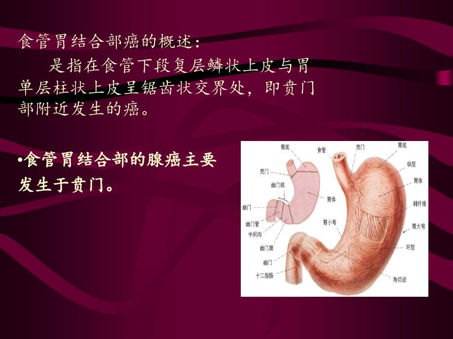 食道胃底结合部癌_第2页