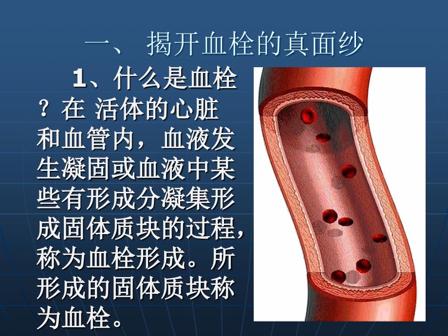 血栓心脑血管疾病的元凶_第3页